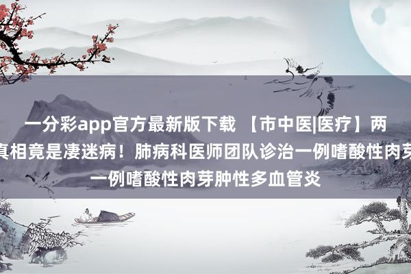 一分彩app官方最新版下载 【市中医|医疗】两年咳嗽煎熬，真相竟是凄迷病！肺病科医师团队诊治一例嗜酸性肉芽肿性多血管炎